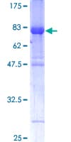 Human IRF6 Protein (Recombinant GST)