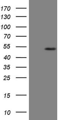 B4GALT4 Antibody (aa40-322, clone OTI8B6, Carrier-free)