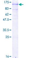 Human SAE2 / UBA2 Protein (Recombinant GST)