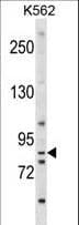EXT1 Antibody (aa298-326)