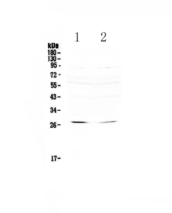 Polyclonal Rabbit anti-Human RNF186 Antibody (WB)