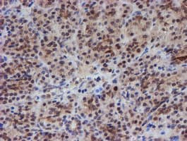 ATRIP Antibody (clone OTI5E7)