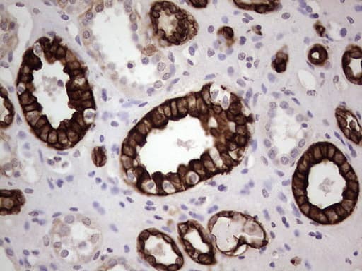 KRT19 / CK19 / Cytokeratin 19 Antibody (aa240-390, clone OTI5B11)