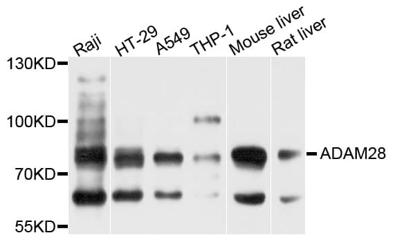 Polyclonal Rabbit anti-Human ADAM28 Antibody (WB)