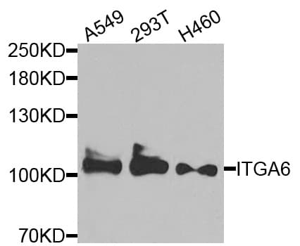 ITGA6/Integrin Alpha 6/CD49f Antibody