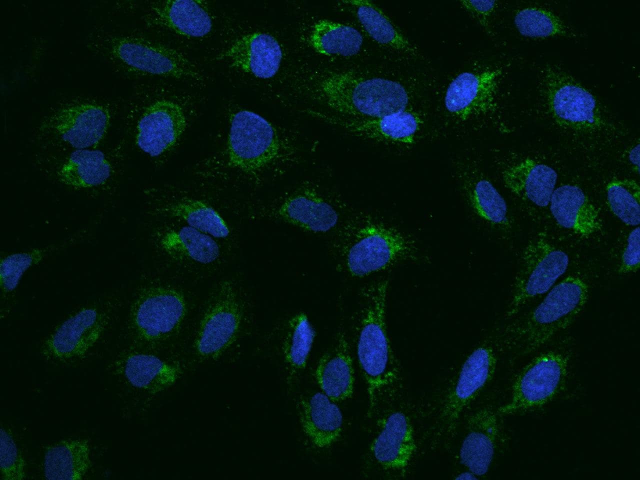 PNPT1 Antibody