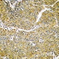 Polyclonal Rabbit anti-Human SVOP Antibody (Internal, IHC, WB)