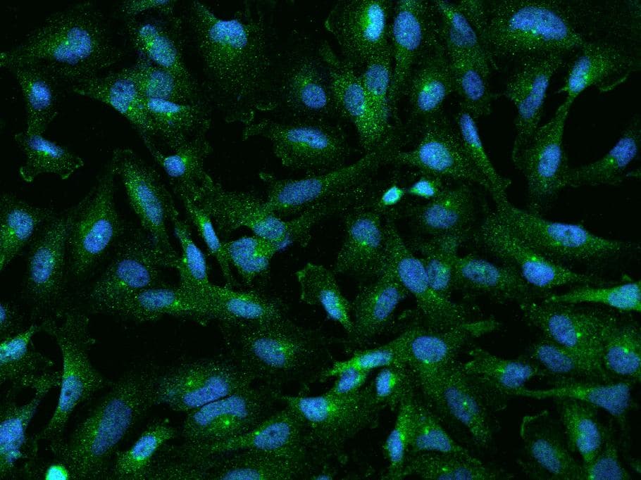 RABEP1 / Rabaptin-5 Antibody