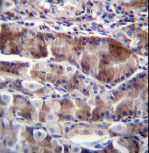 Polyclonal Rabbit anti-Human NRSN2 Antibody (aa128-157, IHC, WB)