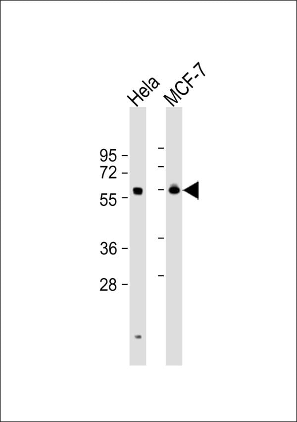 DKC1 / Dyskerin Antibody