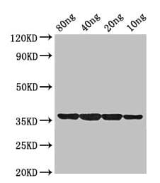 Polyclonal Rabbit anti-Mycobacterium smegmatis dps Antibody (WB)