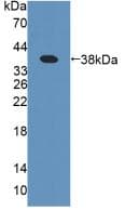 Procollagen III N-Terminal Propeptide Antibody (APC)