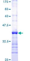 Human PLCG1 Protein (Recombinant GST, N-terminus)