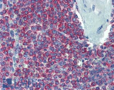 IHC-plus™ Polyclonal Rabbit anti-Human ARPC1B / p41-ARC / ARP2 Antibody (aa272-322, IHC, WB)