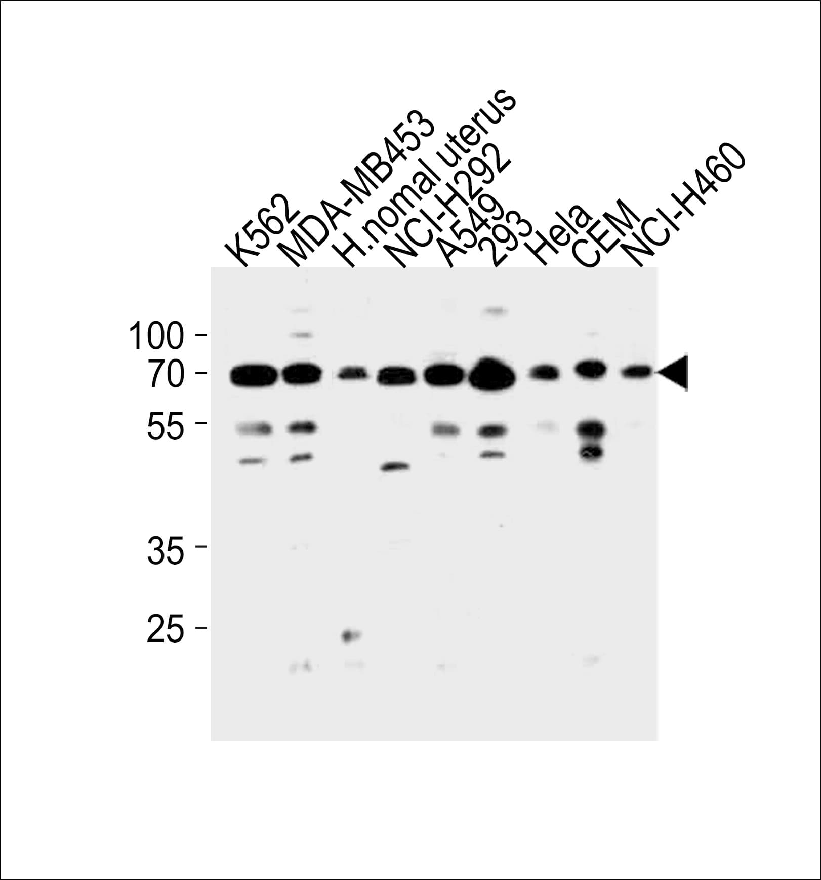 PARP3 Antibody (aa99-126)