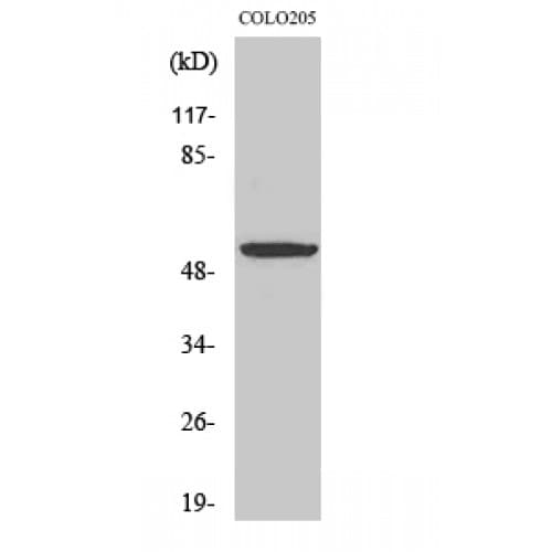 Polyclonal Rabbit anti-Human PTGER4 / EP4 Antibody (300-380 aa, Internal, IF, WB)