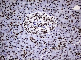 NBN / Nibrin Antibody (clone OTI7D5)