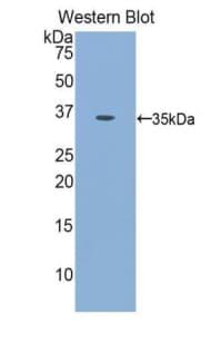INSR / Insulin Receptor Antibody (aa1024-1298, FITC)