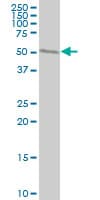 WARS Antibody (clone 3A12)