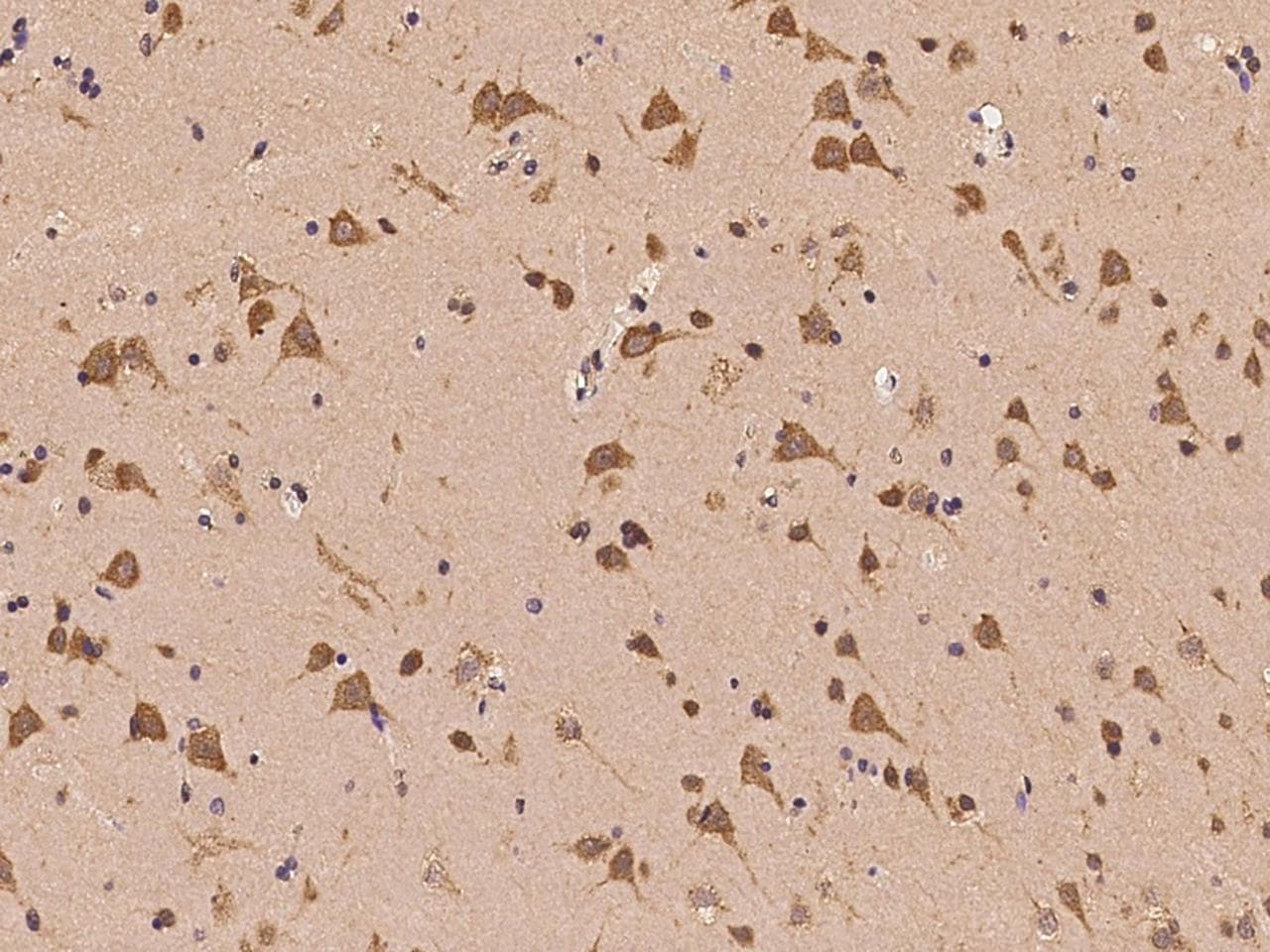 Polyclonal Rabbit anti-Human UBAP2L Antibody (IHC, IF)