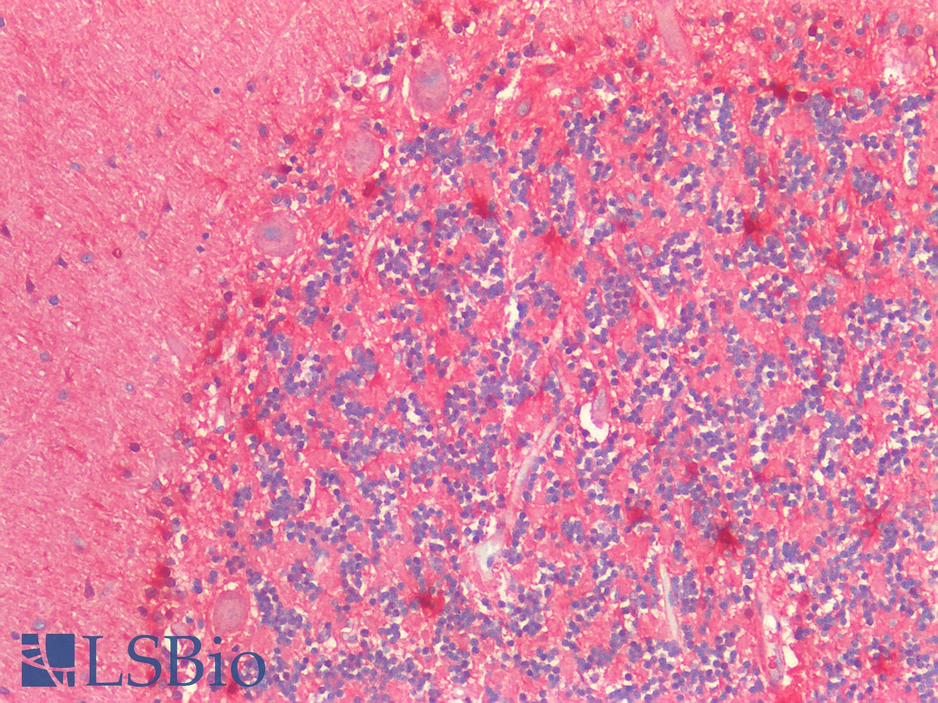 IHC-plus™ Polyclonal Rabbit anti-Human S100A1 / S100-A1 Antibody (N-Terminus, IHC, IF, WB)