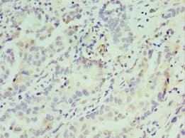 Polyclonal Rabbit anti-Human ATF7 Antibody (aa1-117, IHC, WB)
