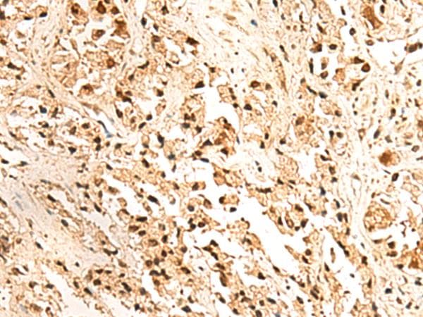 HN1L Antibody