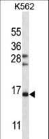 Polyclonal Rabbit anti-Human FSHB / FSH Beta Antibody (aa36-64, WB)