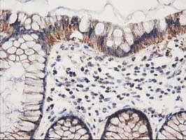 HARS2 Antibody (clone OTI6F9, Carrier-free)