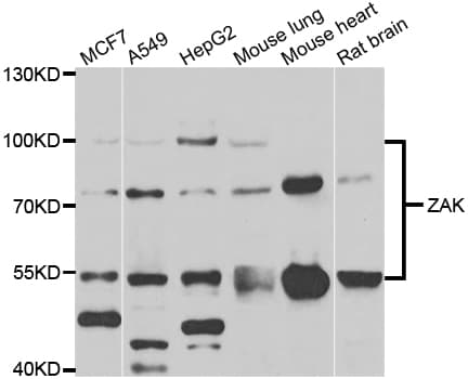 ZAK / MLTK Antibody