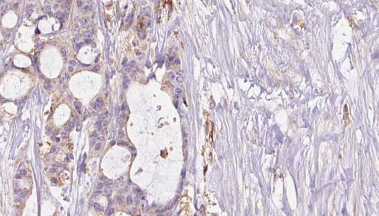 NOS1 / nNOS Antibody (phospho-Ser852)