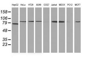 CTNNB1 / Beta Catenin Antibody (clone OTI2F6)