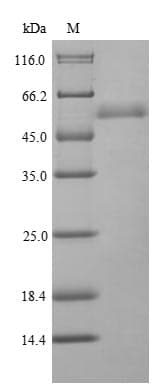 Chironex fleckeri Toxin CfTX-1 Protein (Recombinant 6His-SUMO, N-terminus)