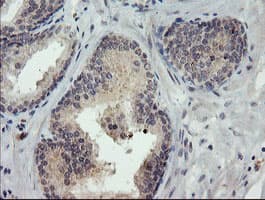 EEYORE / TIGD1 Antibody (aa1-267, clone OTI4G9)