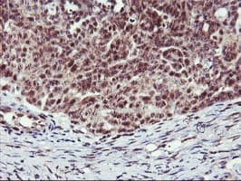 Monoclonal Mouse anti-Human MGLL / Monoacylglycerol Lipase Antibody (clone OTI1B1, IHC, IF, WB)