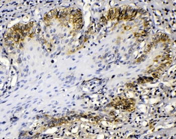 KRT14 / CK14 / Cytokeratin 14 Antibody