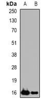 Polyclonal Rabbit anti-Human PLA2G2D Antibody (IF, WB)