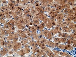 EPM2AIP1 Antibody (clone OTI2G3)