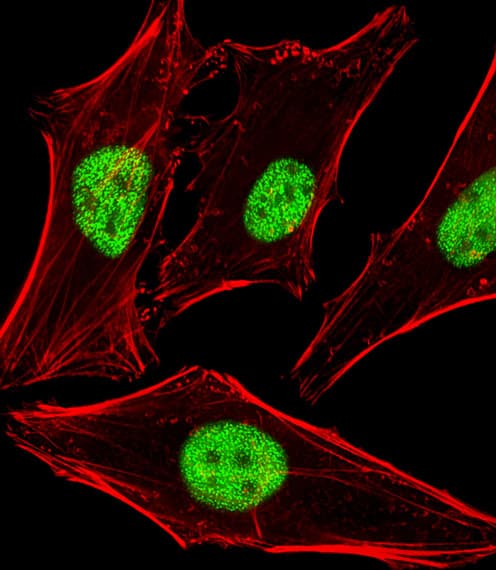 PPHLN1 Antibody (aa45-66)