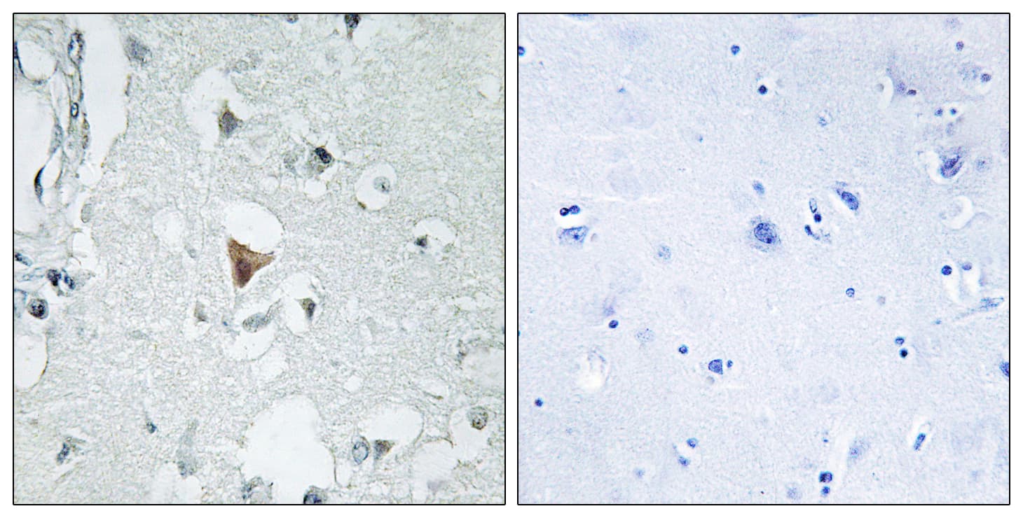JNK1+2+3 Antibody (Internal)