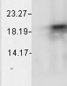 IHC-plus™ CRYAB / Alpha B Crystallin Antibody (clone 1A7.D5)