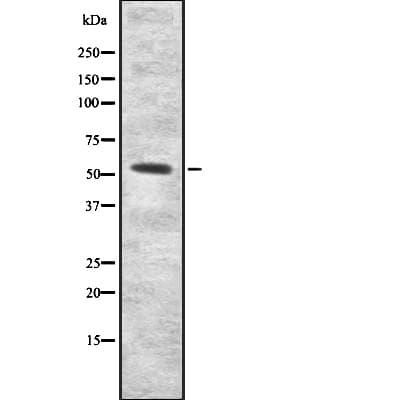 Polyclonal Rabbit anti-Human IFNAR2 Antibody (IHC, WB)