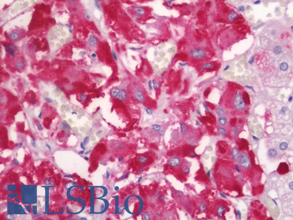 IHC-plus™ FE65L1 / APBB2 Antibody (aa475-524)