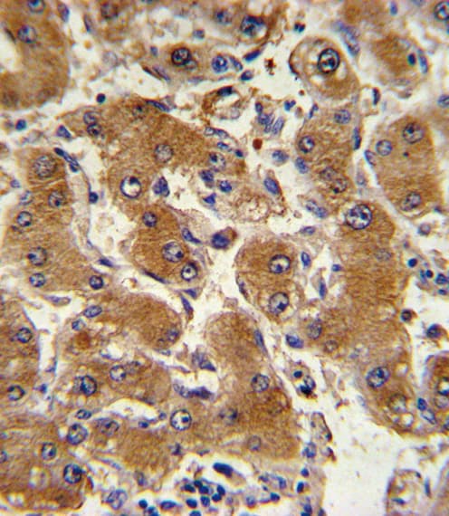 Polyclonal Rabbit anti-Human COL6A1 / Collagen VI Alpha 1 Antibody (aa831-858, IHC, IF, WB)