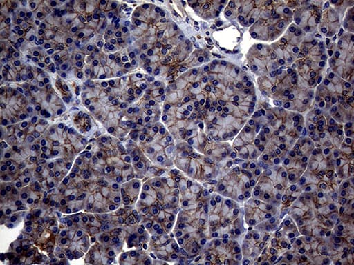 ABCB1 / MDR1 / P Glycoprotein Antibody (aa995-1280, clone OTI16D9, Carrier-free)