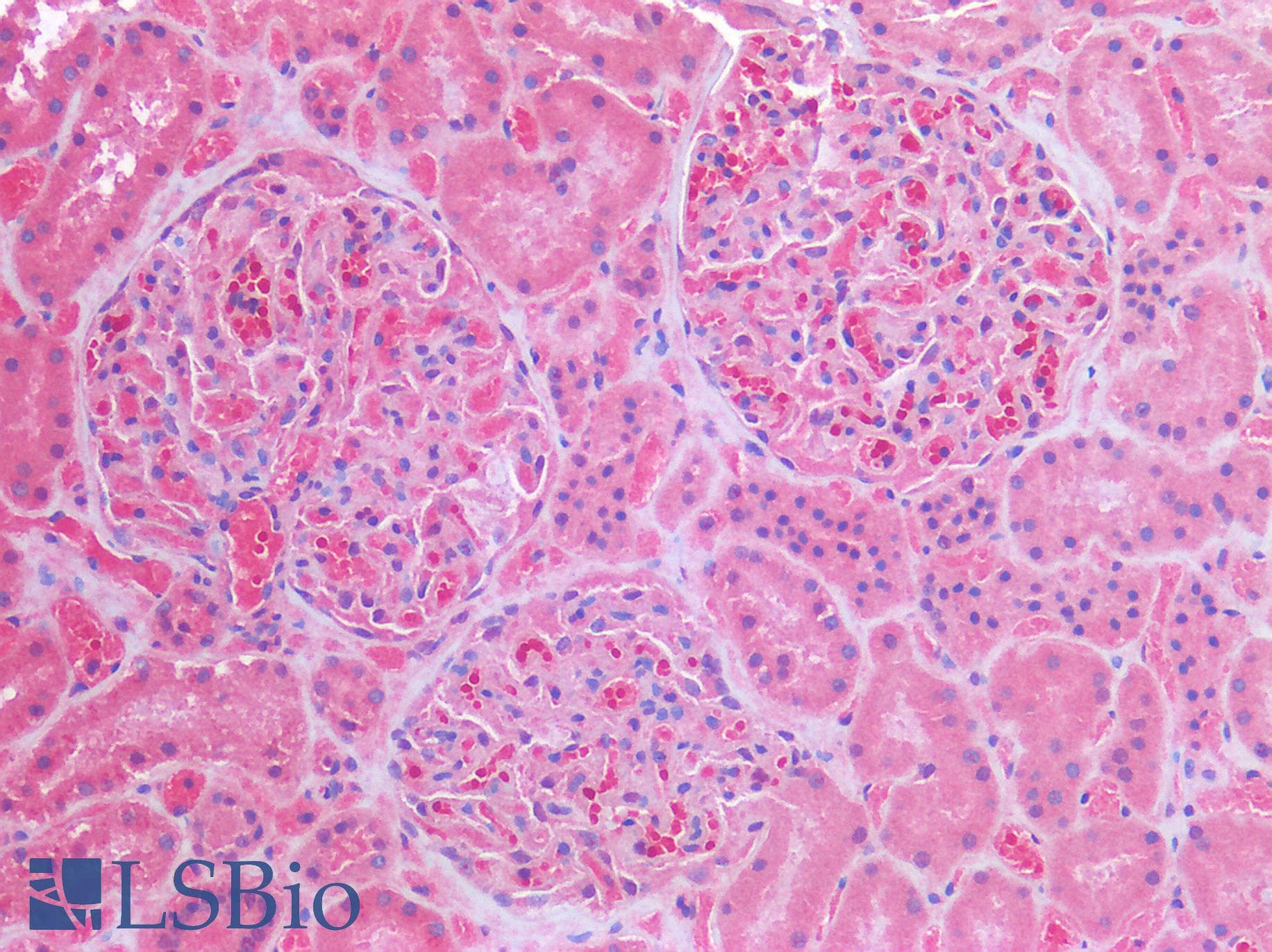 IHC-plus™ ERBB3 / HER3 Antibody