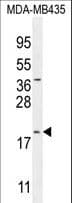 C20orf173 Antibody (aa48-76)