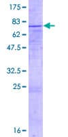 Human CTSA / Cathepsin A Protein (Recombinant GST)