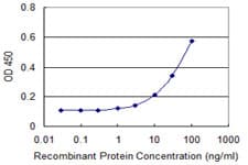 PSMB8 / LMP7 Antibody (clone 1B3)