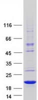 Human WHAMMP3 Protein (Recombinant Myc-DDK (Flag))
